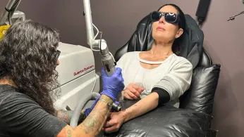 If You Want That Tattoo Erased It's Going to Hurt and It's Going to Cost You